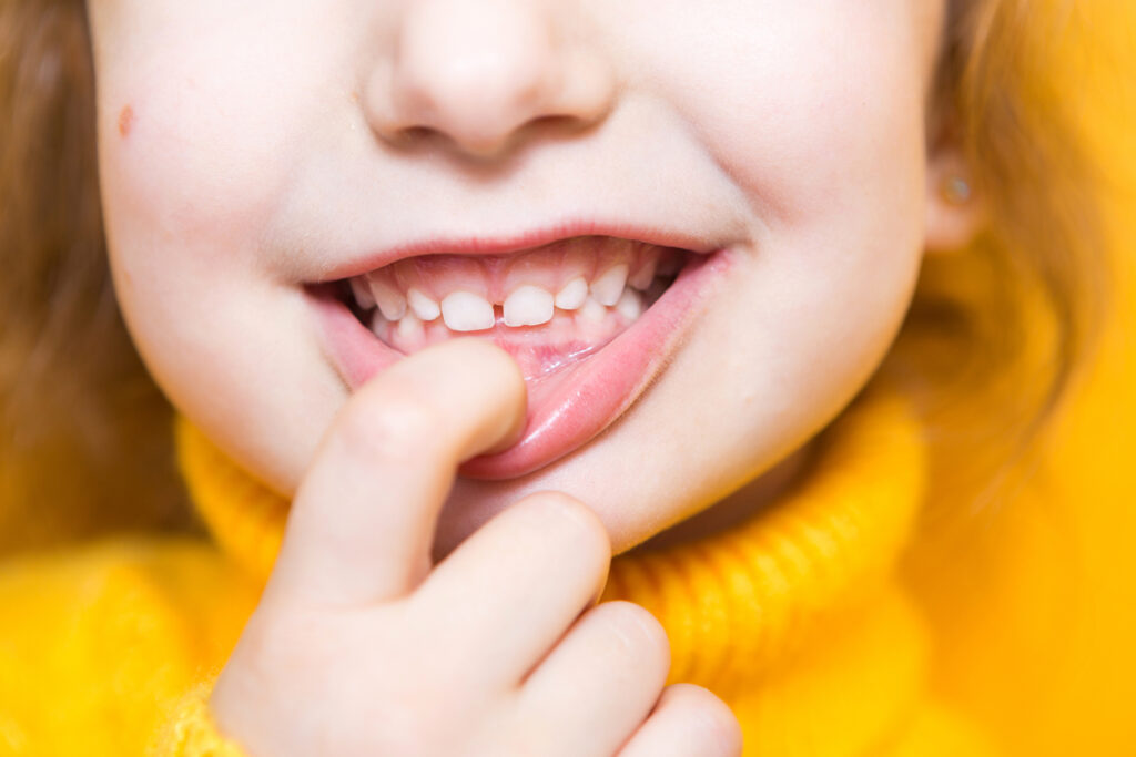 baby teeth need dental care too